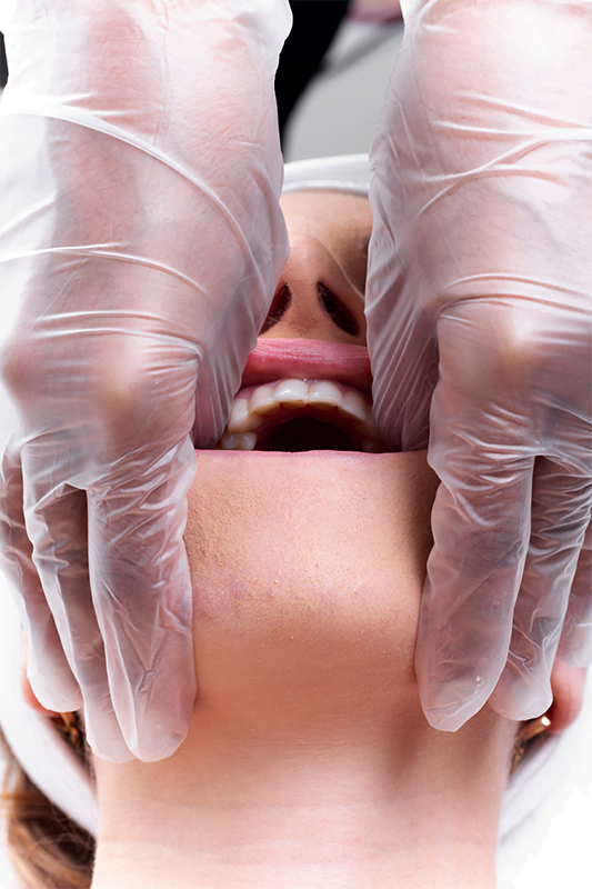 Detalle del trabajo intraoral cuidadoso realizado con guantes