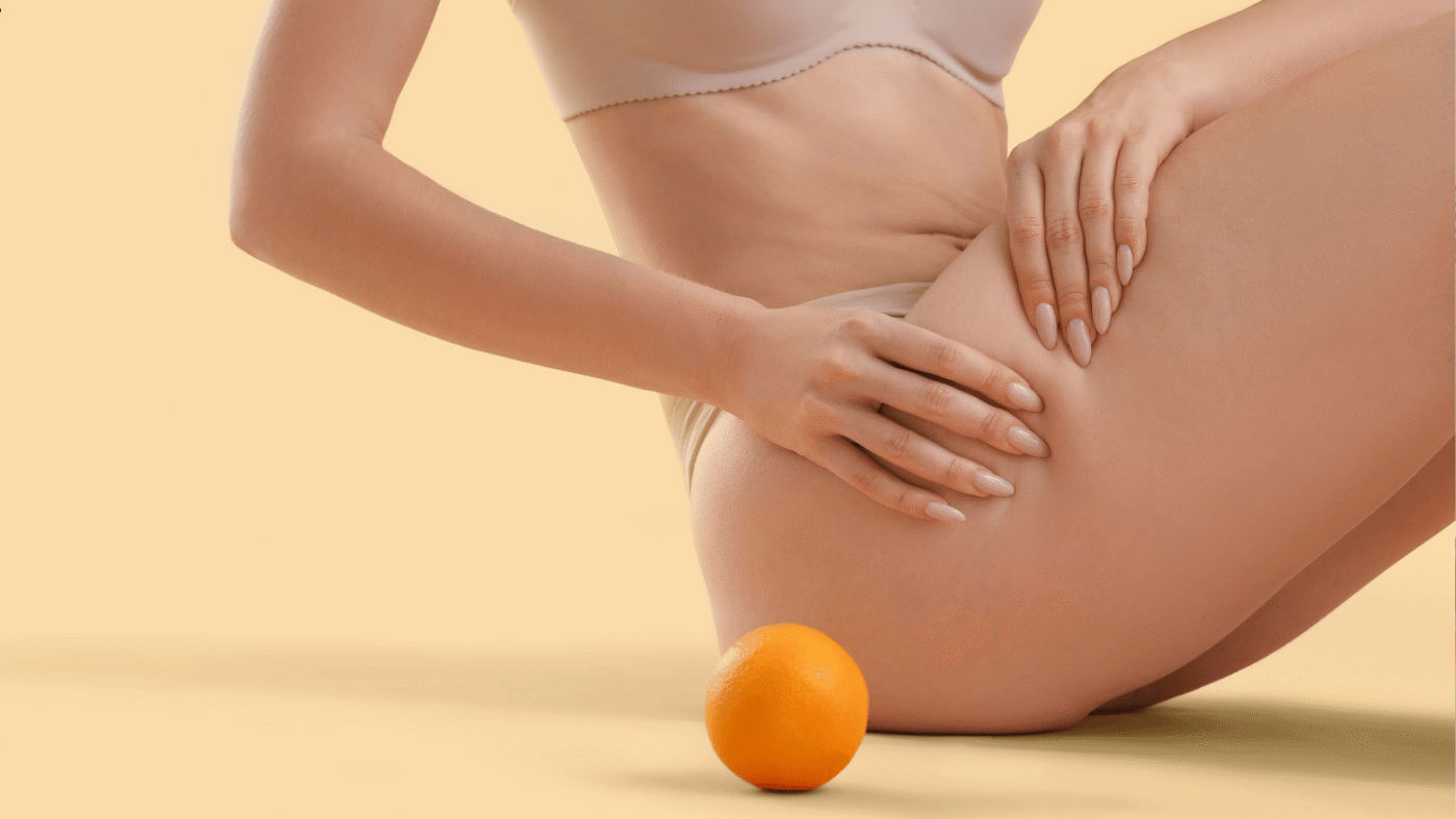 Piernas femeninas mostrando piel más lisa tras plan integral para celulitis.